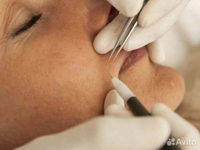 Депиляция с воском. электроэпиляция Шугаринг Депиляция с воском. электроэпиляция Шугаринг